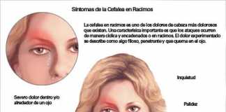 cefaleas-racimo