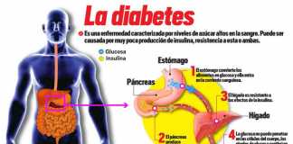diabetes-post-vacacional