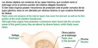 ulcera-peptica