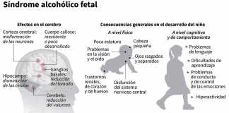 alcohol-feto