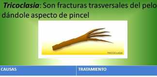 tricoclasia