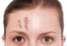 maquillajelesiones