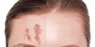 maquillajelesiones