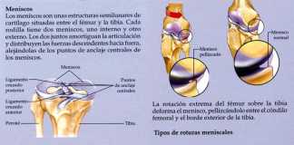 rodilla