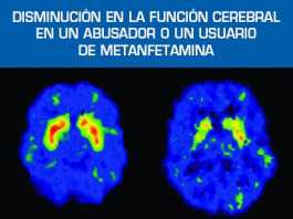 metanfetaminas1