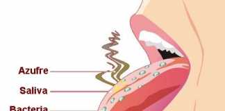 halitosis