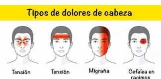 dolor-cabeza