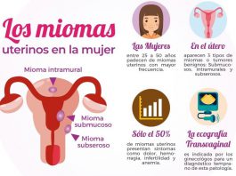 miomas