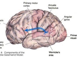 Apraxia