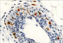 Investigan sobre el rejuvenecimiento de las células madre hematopoyéticas Cdc42-topic-image