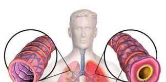 Como-se-presenta-la-bronquitis-en-nuestro-organismo