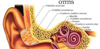 Diferentes-síntomas-y-diagnósticos-para-la-otitis