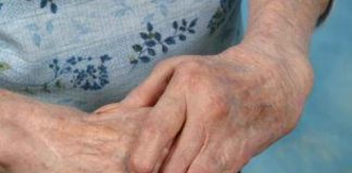 Existe-una-asociación-entre-la-artritis-reumatoide-y-el-riesgo-de-coágulos