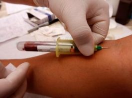 Exámenes-médicos-para-detectar-a-la-hepatitis-A