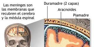 Formas-y-alternativas-para-tratar-a-la-meningitis