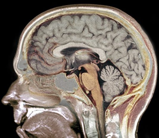 Identificación de genes involucrados en el sistema nervioso cerebro-inteligencia-gen