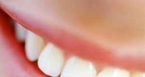 dientes-blancos