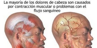 dolor-de-cabeza