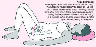 ejercicios-de-kegel