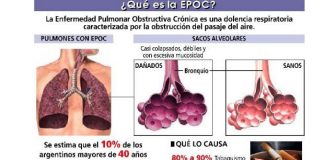 epoc