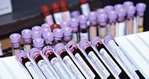 examen-sangre-cancer