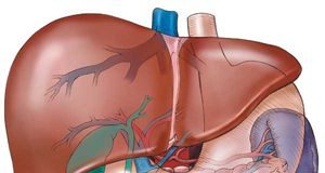 hepatitis