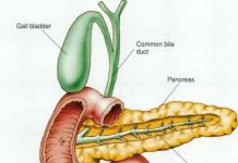 pancreatitis