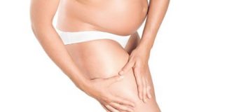 varices